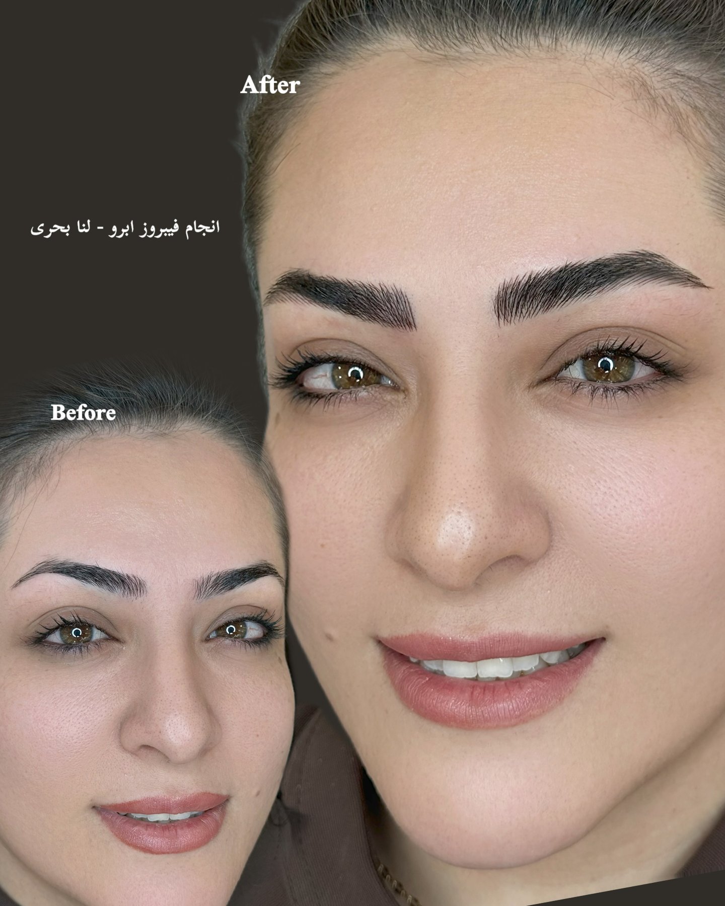 فیبروز ابرو؛ قبل و بعد — ابرو