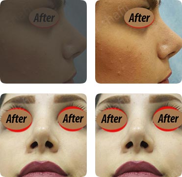 نمونه عمل‌های جراحی